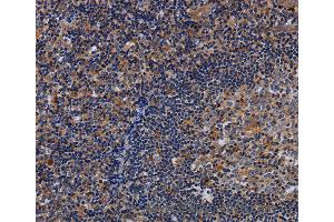Immunohistochemistry of Human tonsil using LIMS1 Polyclonal Antibody at dilution of 1:40