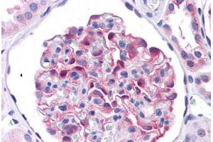 Human Kidney: Formalin-Fixed, Paraffin-Embedded (FFPE)