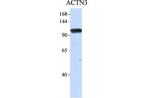 Host:  Rabbit  Target Name:  ACTN3  Sample Type:  Human 293T  Antibody Dilution:  1.