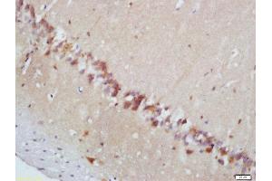 Formalin-fixed and paraffin embedded mouse brain labeled with Rabbit Anti-MAPKAPK2 (Thr222) Polyclonal Antibody, Unconjugated  at 1:200 followed by conjugation to the secondary antibody and DAB staining