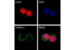 Immunofluorescence (IF) image for anti-B-Cell CLL/lymphoma 11B (Zinc Finger Protein) (BCL11B) antibody (ABIN2666299)