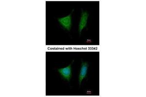 ICC/IF Image Immunofluorescence analysis of methanol-fixed HeLa, using EIF3 beta, antibody at 1:200 dilution. (EIF3I anticorps)