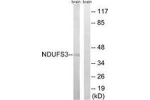 Western blot analysis of extracts from mouse brain cells, using NDUFS3 Antibody. (NDUFS3 anticorps  (AA 117-166))