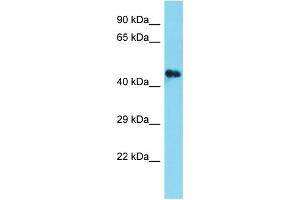 Host: Rabbit Target Name: C3orf32 Sample Type: Fetal Brain lysates Antibody Dilution: 1. (SSUH2 anticorps  (N-Term))