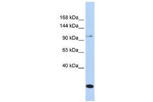 TRPC6 antibody used at 1 ug/ml to detect target protein.