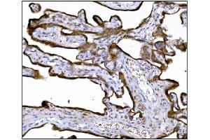 IHC analysis of LRP1B using anti-LRP1B antibody (ABIN7601521). (LRP1B anticorps  (AA 3704-4547))