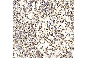 IHC analysis of Epac1/RAPGEF3 using anti-Epac1/RAPGEF3 antibody (ABIN7601858). (RAPGEF3 anticorps  (AA 49-881))