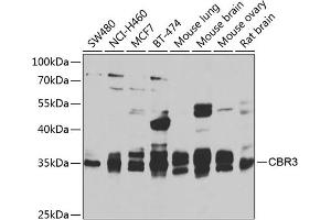 Western blot analysis of extracts of various cell lines, using CBR3 antibody  at 1:1000 dilution. (CBR3 anticorps  (AA 118-277))
