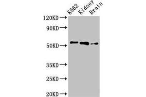 PFKFB2 antibody  (AA 360-505)