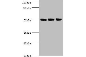 Western blot All lanes: ORC4 antibody at 4 μg/mL Lane 1: Hela whole cell lysate Lane 2: Jurkat whole cell lysate Lane 3: A549 whole cell lysate Secondary Goat polyclonal to rabbit IgG at 1/10000 dilution Predicted band size: 51, 41, 43 kDa Observed band size: 51 kDa