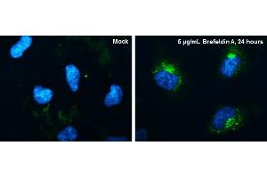 ICC/IF Image CYR61 antibody [N1C3] detects CYR61 protein at endoplasmic reticulum by immunofluorescent analysis. (CYR61 anticorps  (Center))
