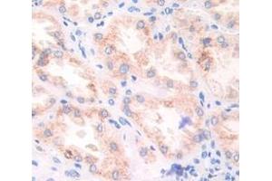 IHC-P analysis of Kidney tissue, with DAB staining. (Fibronectin anticorps  (AA 2206-2337))