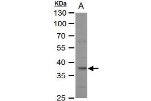 WB Image LDH-B antibody detects LDH-B protein by western blot analysis. (LDHB anticorps)