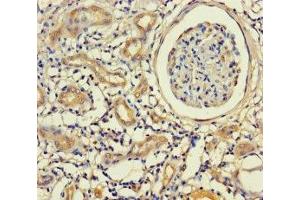 Immunohistochemistry of paraffin-embedded human kidney tissue using ABIN7157448 at dilution of 1:100 (Keratin 71 anticorps  (AA 201-500))
