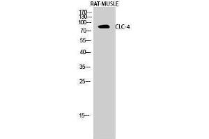 Western Blotting (WB) image for anti-Chloride Channel 4 (CLCN4) (Internal Region) antibody (ABIN3174434) (CLCN4 anticorps  (Internal Region))