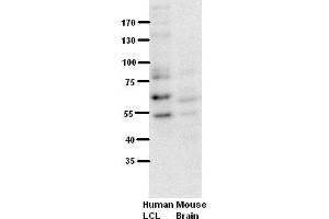 WB Suggested Anti-RUNX1 Antibody Titration:  5% Milk  ELISA Titer:  dilution: 1:500  Positive Control:  Human LCL and mouse brains