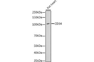 Western blot analysis of extracts of Rat heart, using CD34 antibody (ABIN3021123, ABIN3021124, ABIN3021125, ABIN1512704 and ABIN6213981) at 1:1000 dilution.