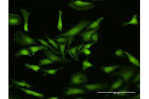 Immunofluorescence of purified MaxPab antibody to NLRP2 on HeLa cell.
