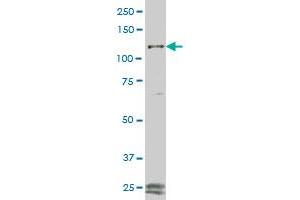 FGFR1 monoclonal antibody (M08), clone 1E4 Western Blot analysis of FGFR1 expression in COLO 320 HSR . (FGFR1 anticorps  (AA 303-408))