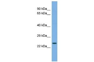 Host:  Rabbit  Target Name:  FAP  Sample Type:  COLO205 Whole cell lysates  Antibody Dilution:  1. (FAP anticorps  (C-Term))