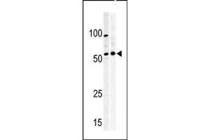 Western blot analysis of anti-PKMYT1 Pabin A375 (left) and Y79 (right) cell line lysate.