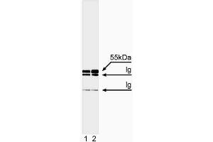 Immunoprecipitation/western blot analysis of caspase-8. (Caspase 8 anticorps  (full length))