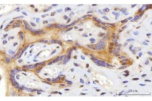 IHC analysis of CEP250 using anti-CEP250 antibody (ABIN7602053). (CEP250 anticorps  (AA 563-853))