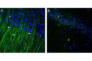 Expression of TRPM6 in rat hippocampus. (TRPM6 anticorps  (1st Extracellular Loop))