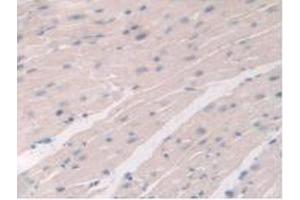 IHC-P analysis of Mouse Heart Tissue, with DAB staining. (DDX58 anticorps  (AA 1-211))