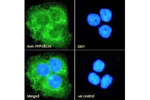 (ABIN6391349) Immunofluorescence analysis of paraformaldehyde fixed A431 cells, permeabilized with 0. (PPP1R12A anticorps  (C-Term))