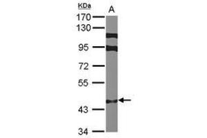 Image no. 1 for anti-Zinc Finger Protein 384 (ZNF384) (N-Term) antibody (ABIN1494117) (ZNF384 anticorps  (N-Term))