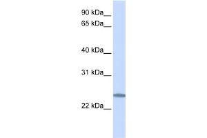 WB Suggested Anti-C12orf49 Antibody Titration:  0. (C12orf49 anticorps  (C-Term))
