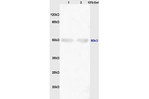 Lane 1: mouse embryo lysates Lane 2: rat brain lysates probed with Anti ShhPolyclonal Antibody, Unconjugated (ABIN731108) at 1:200 in 4 °C.
