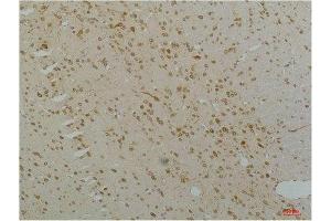 Immunohistochemistry (IHC) analysis of paraffin-embedded Rat Brain Tissue using Cav1.