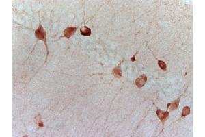 Mouse hippocampus labeled with Anti-GAD-67 Polyclonal Antibody, Unconjugated (ABIN674679) followed by conjugation to the secondary antibody and DAB staining