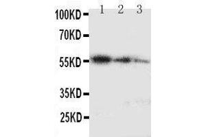 Lane 3: Recombinant Human Ki67 Protein 2. (Ki-67 anticorps  (C-Term))
