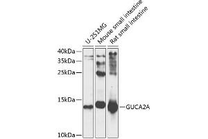 Western blot analysis of extracts of various cell lines, using GUCA antibody (ABIN6127993, ABIN6141529, ABIN6141530 and ABIN6225126) at 1:1000 dilution. (GUCA2A anticorps  (AA 22-115))