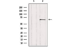Western blot analysis of extracts from Hepg2, using SLC28A2 Antibody.