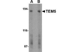 Western blot analysis of TEM5 in human bladder tissue lysate with this product at (A) 2 and (B) 4 μg/ml. (GPR124 anticorps  (C-Term))