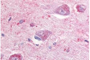 Human Brain, Hippocampus (formalin-fixed, paraffin-embedded) stained with GPR22 antibody ABIN213334 at 10 ug/ml followed by biotinylated goat anti-rabbit IgG secondary antibody ABIN481713, alkaline phosphatase-streptavidin and chromogen.