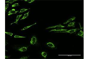 Immunofluorescence of purified MaxPab antibody to HSPD1 on HeLa cell.
