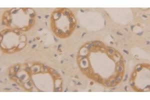 Detection of CLC in Human Kidney Tissue using Polyclonal Antibody to Charcot Leyden Crystal Protein (CLC) (Galectin 10 anticorps  (AA 2-142))