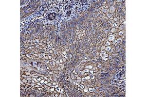 IHC analysis of CD147/Emmprin using anti-CD147/Emmprin antibody (ABIN7599999). (CD147 anticorps  (AA 138-323))