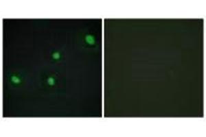 Immunofluorescence analysis of HepG2 cells, using CDCA4 antibody. (CDCA4 anticorps)