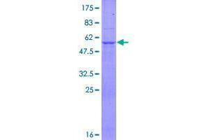 Image no. 1 for Udp-N-Acetyl-alpha-D-Galactosamine:polypeptide N-Acetylgalactosaminyltransferase 9 (GalNAc-T9) (GALNT9) (AA 1-237) protein (GST tag) (ABIN1354758)