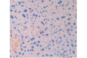 IHC-P analysis of Mouse Liver Tissue, with DAB staining. (CD47 anticorps  (AA 18-219))