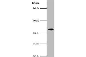 Western blot analysis of recombinant Carboxypeptidase G2 (0. (Carboxypeptidase G2 anticorps  (AA 23-415))