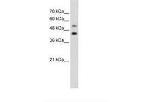 Image no. 1 for anti-GTP Binding Protein 2 (GTPBP2) (AA 511-560) antibody (ABIN203420) (GTPBP2 anticorps  (AA 511-560))
