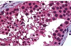 Human Testis: Formalin-Fixed, Paraffin-Embedded (FFPE)