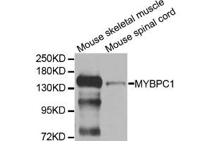Western blot analysis of extracts of mouse skeletal muscle and mouse spinal cord cell lines, using MYBPC1 antibody. (MYBPC1 anticorps)